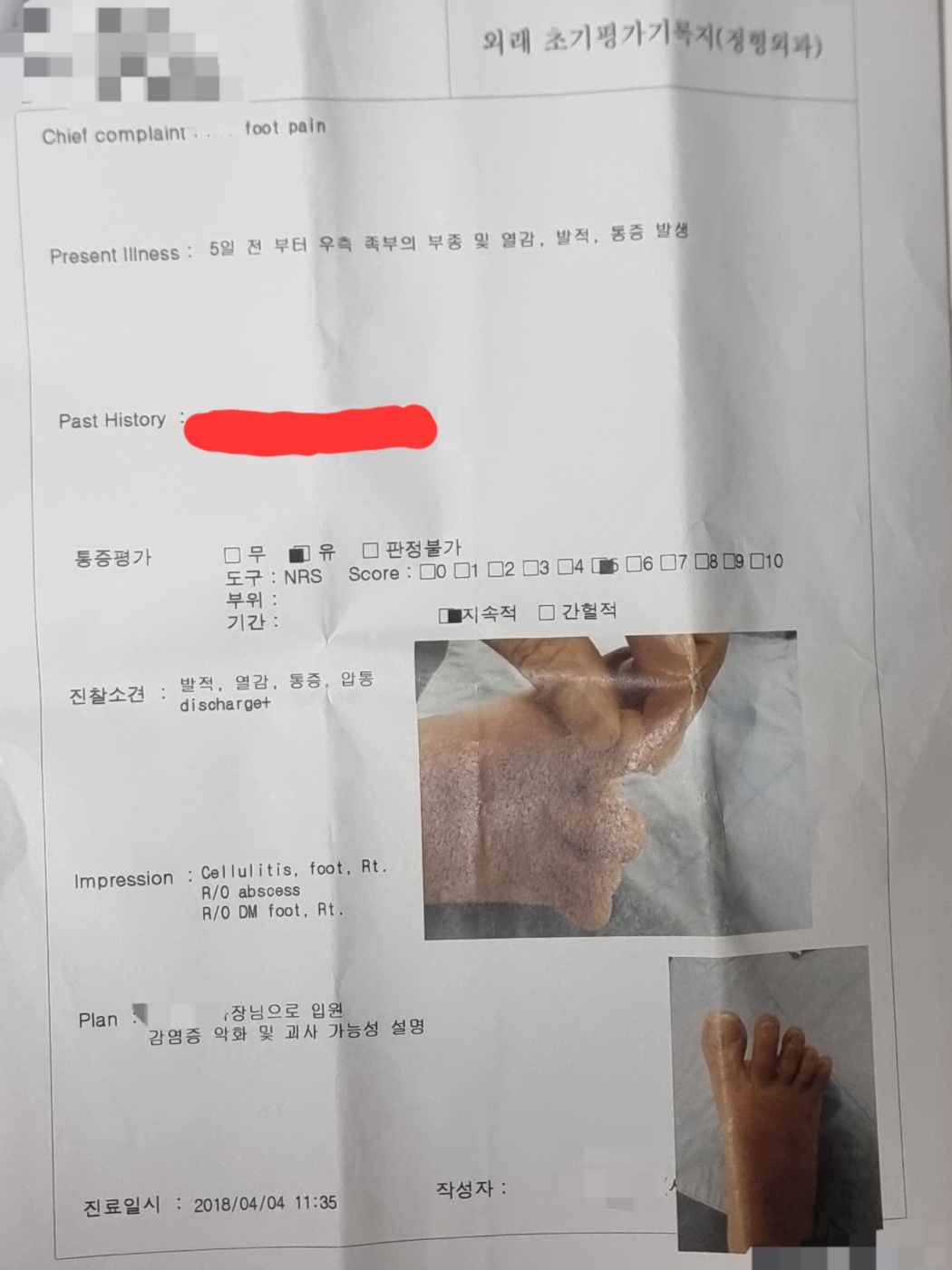 A 2018 medical chart showing a diagnosis of 'Cellulitis, foot, Rt.' and 'R/O DM foot,' with photos of the infected foot.